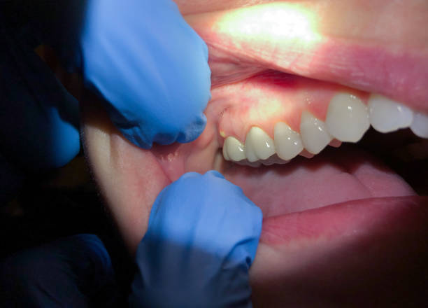 Best Cracked Tooth Emergency Dentist  in Shelbyville, TN